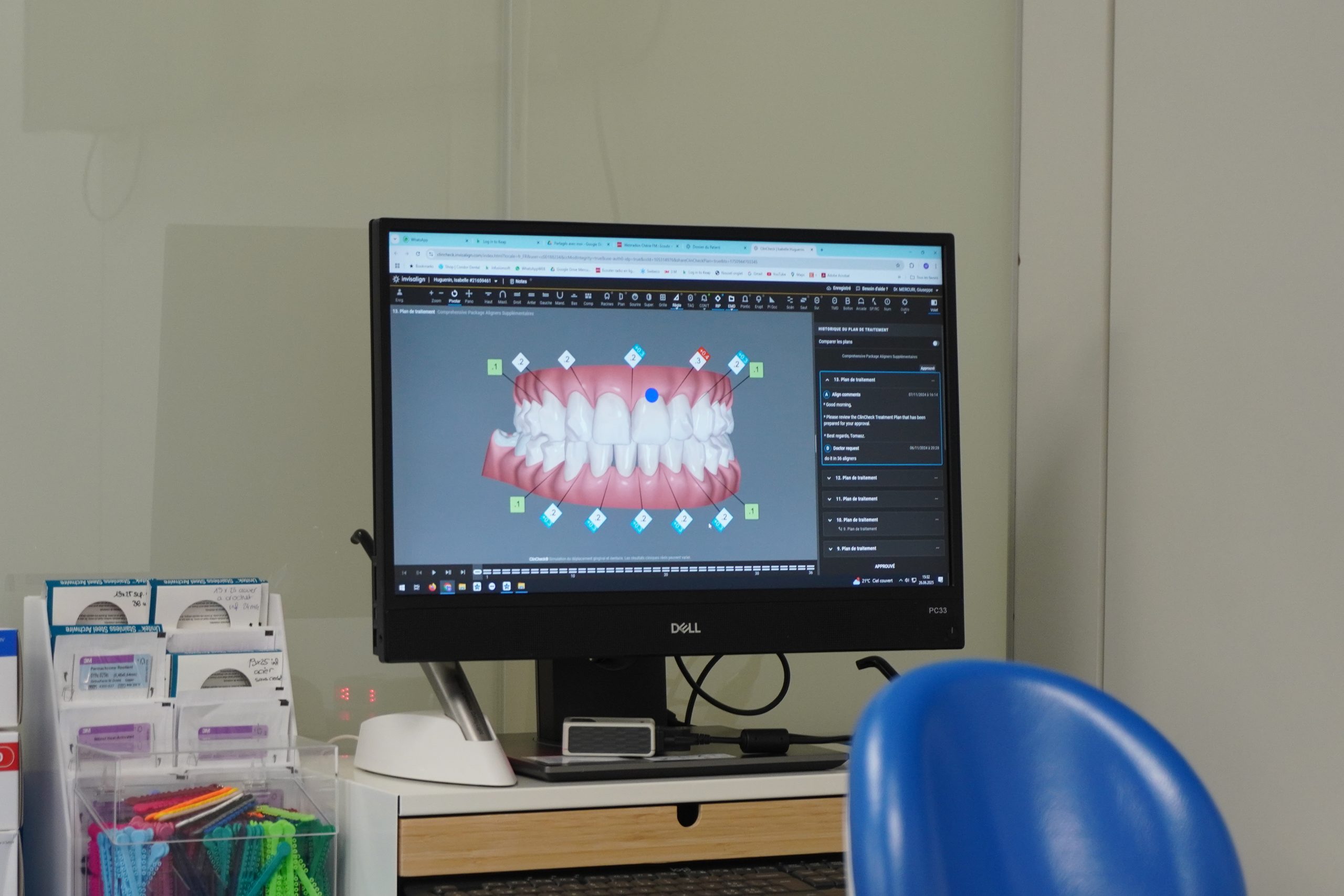 résultats orthodontie avant/après Mercuri