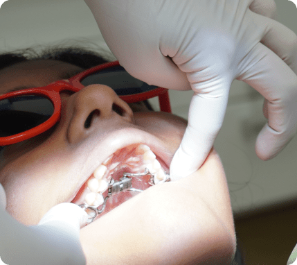 Traitements orthodontiques précoces enfants Écublens